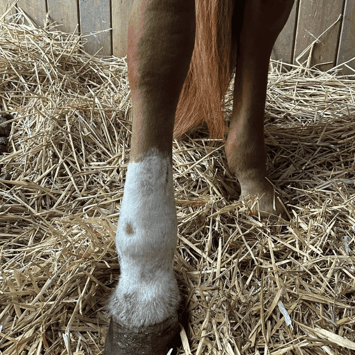 Gale de boue avec lymphœdème 