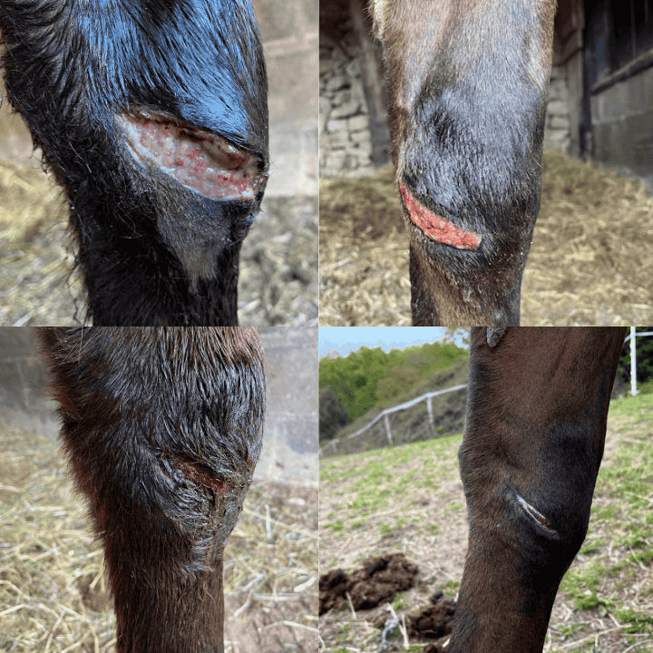 Les phases naturelles de la cicatrisation